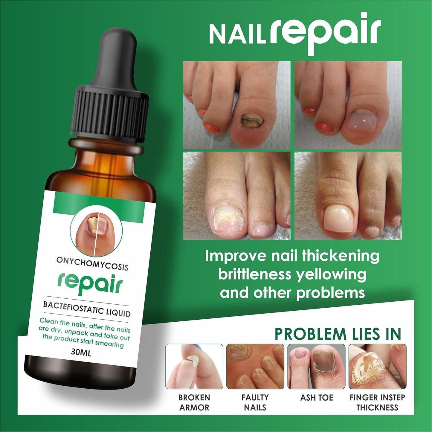 Nail Serum For Complete Nail Protection, Long healthy & fungus free nails ( pack of 2 )